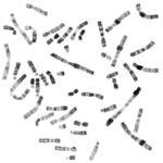 cytogenetika, karyotypizace